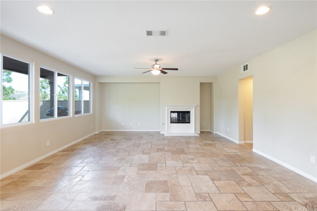 Before staging
